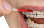PLAQUE *) | auch in der Pandemie 'grade' & gesunde Zähne'